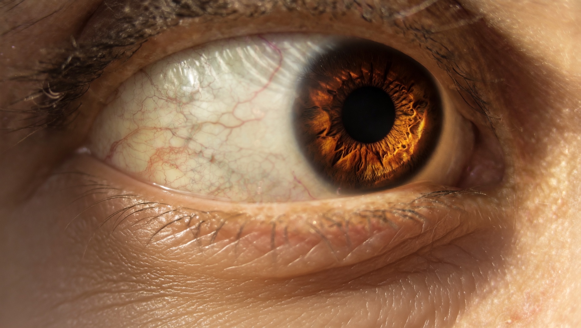Ojo bajo luz natural, sin fluorescencia visible